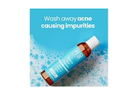 Seoul Ceuticals Korean Skin Care Face Wash for Acne Prone Skin Miracle Clear Face Cleanser K Beauty Skincare