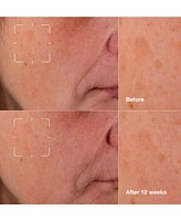 Clinique Even Better Clinical Dark Spot Clearing Serum with Vitamin C