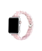 Posh Tech Kit Tortoise Resin Link Band for Apple Watch