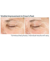 StriVectin Advanced Retinol Multi-Correct Eye Cream
