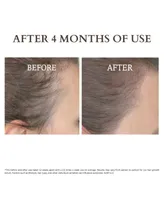 Solaris Laboratories Ny Anti Hair Loss Pre Shampoo Treatment Serum