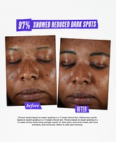 Kiehl's Since 1851 Dermatologist Solutions Clearly Corrective Dark Spot Solution, 3.8 oz.