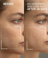 Dr. Brandt Microdermabrasion Renewing Face Exfoliator, 2 oz.
