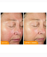 BeautyStat Universal C Skin Refiner 20% Vitamin C Brightening Serum + Spf 50 Mineral Sunscreen, 1oz.