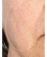 Perricone Md Hp Intensive Smoothing Serum, 2.0 oz