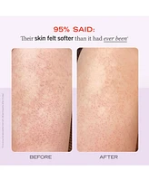 First Aid Beauty Kp Bump Eraser Body Scrub With 10% Aha