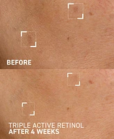 Dr. Brandt Triple Active Retinol Gentle Overnight Renewal Cream, 1 oz.