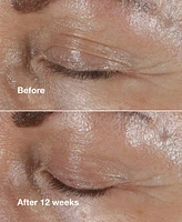 Last Day! Spend $80, Get Even More! Free Full-size Smart Clinical Repair Eye Cream with any $80 Clinique purchase (Up to a $214 Value!)