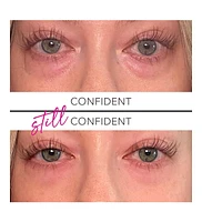 Undereye Firming Gel