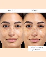Patchology Skin Remedy Calm & Protect Micro Mist