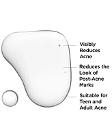 It Cosmetics Bye Bye Breakout Serum