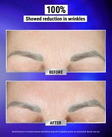Kiehl's Since 1851 Retinol Fast Release Wrinkle-Reducing Night Serum, 0.94 oz.