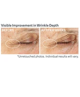 StriVectin Advanced Retinol Multi-Correct Eye Cream