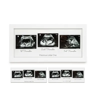 KeaBabies Trio Baby Sonogram Picture Frame, Ultrasound Frames for Nursery, Mom to Be Gifts