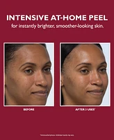 Peter Thomas Roth Even Smoother Instant Reveal Facial Peel, 8