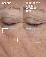 Dr. Brandt Dark Spots No More Triple Acid Spot Minimizing Concentrate, 0.5 oz.