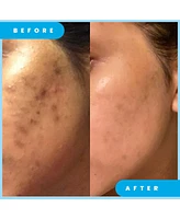 Admire My Skin Dark Spot Corrector Remover for Face Ultra Potent Brightening Serum