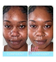 Luminous Undereye Corrector