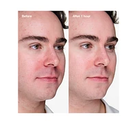 Clinique Acne Solutions Clinical Advanced Clearing Gel With Salicylic Acid