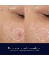 Estee Lauder Advanced Night Repair Rescue Solution Serum with 15% Bifidus Ferment, 0.68 oz.