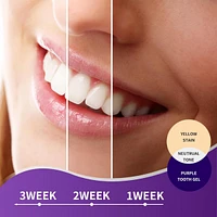 Essential Sonic Toothbrush + Purple Toothpaste Bundle