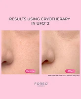 Foreo Ufo 2