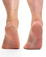 Purecode 3 Step Pedicare with Unscented Argan Oil Set, Socks 10-12, 4 Piece, Created For Macy's