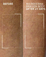 dr. brandt Microdermabrasion Body Polishing Exfoliator