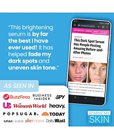 Admire My Skin Dark Spot Corrector Remover for Face Ultra Potent Brightening Serum