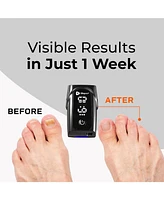 LifePro At-Home Nail Cleaning Light Device - Portable Nail Treatment Tool for Healthy-Looking Nails and Easy Maintenance