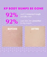 Kopari Beauty Kp Body Bumps Be Gone