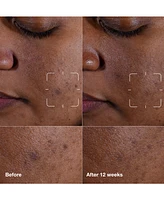 Clinique Even Better Clinical Dark Spot Clearing Serum with Vitamin C