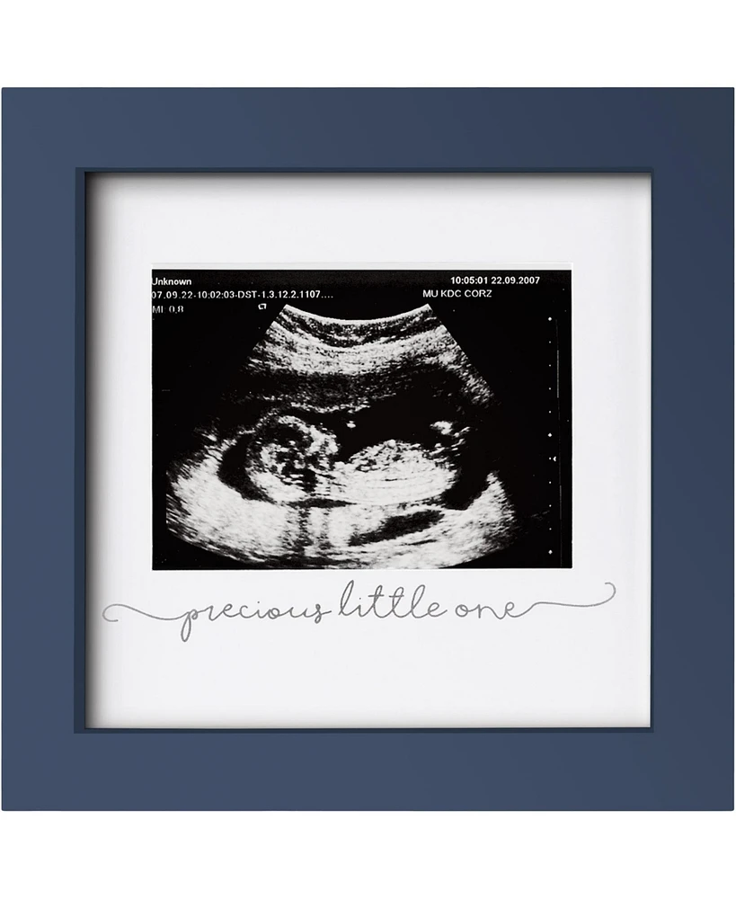 Solo Baby Sonogram Picture Frame, Modern Ultrasound Frames, Pregnancy Announcements Frame