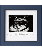 Solo Baby Sonogram Picture Frame, Modern Ultrasound Frames, Pregnancy Announcements Frame