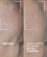 dr. brandt Dark Spots No More