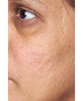 Perricone Md Limited-Edition High Potency Face Finishing & Firming Radiant Moisturizer, 2 oz.