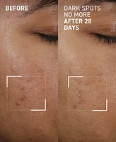 Dr. Brandt Dark Spots No More Triple Acid Spot Minimizing Concentrate, 0.5 oz.
