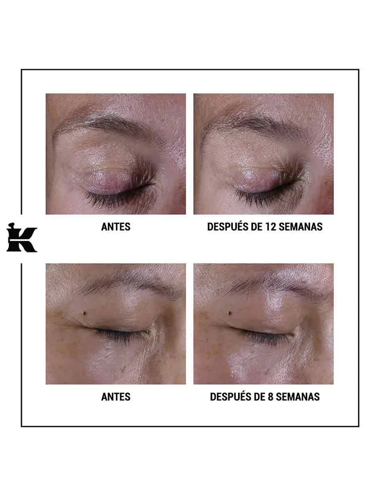 Crema para ojos Super Multi Corrective Kiehl's recomendada para antiedad