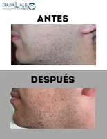 Tratamiento para barba Suero Dabalash