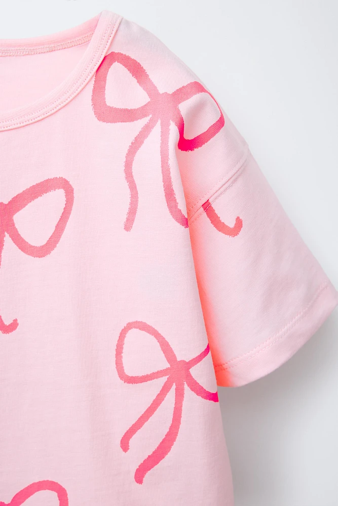 PRINTED T-SHIRT AND BERMUDA SET