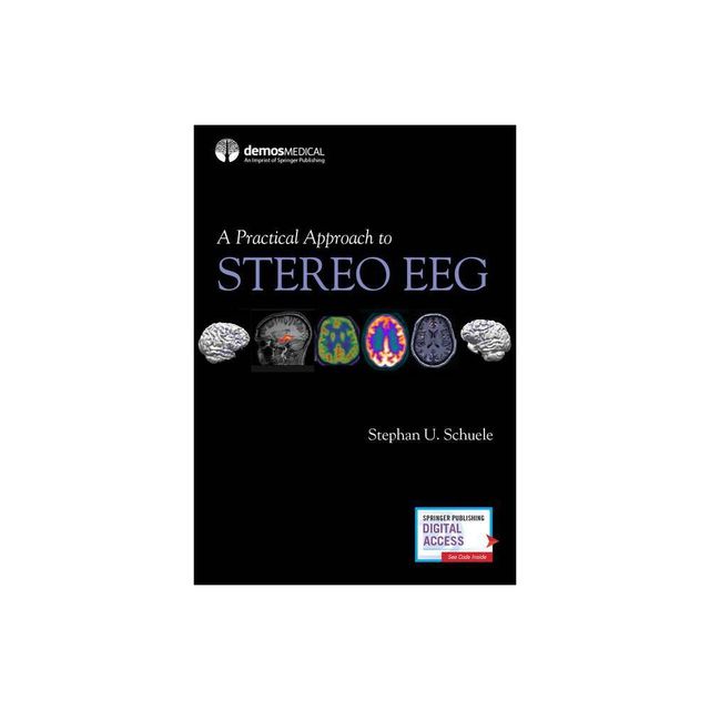 A Practical Approach to Stereo Eeg - by Stephan Schuele (Paperback)