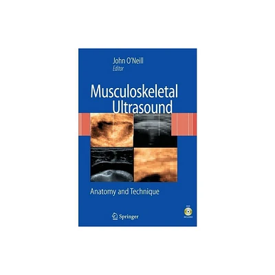 Musculoskeletal Ultrasound - by John M D ONeill (Mixed Media Product)