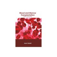 Introducir 11+ imagen blood and marrow transplant near oakley