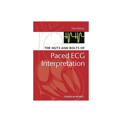 The Nuts and Bolts of Paced ECG Interpretation - by Tom Kenny (Paperback)