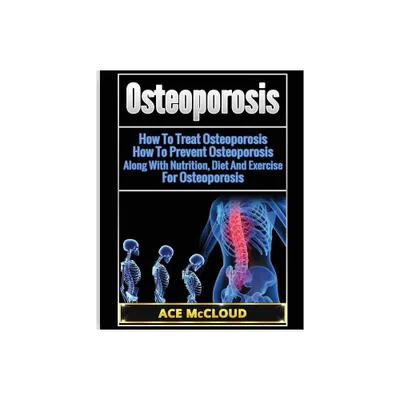 Osteoporosis - (Reverse or Prevent Bone Loss from Osteoporosis All) by Ace McCloud (Paperback)