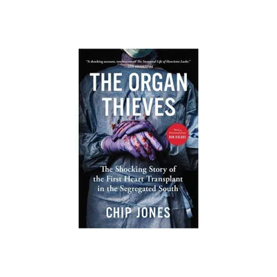 The Organ Thieves - by Chip Jones (Paperback)