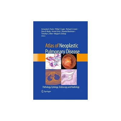 Atlas of Neoplastic Pulmonary Disease - (Hardcover)