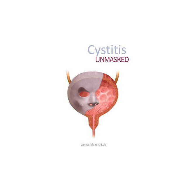 Cystitis Unmasked - by James Malone-Lee (Paperback)