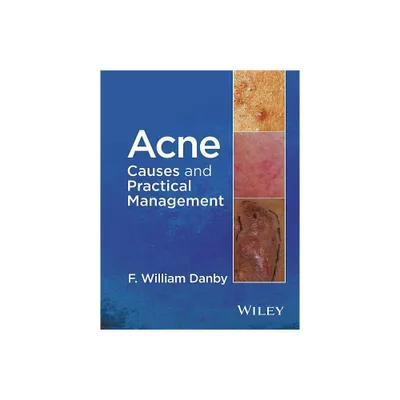 Acne - by F William Danby (Hardcover)