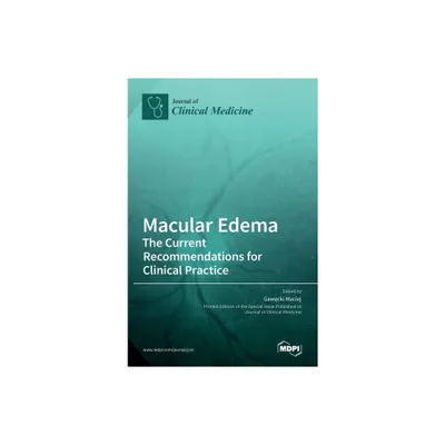 Macular Edema - by Gawecki Maciej (Hardcover)